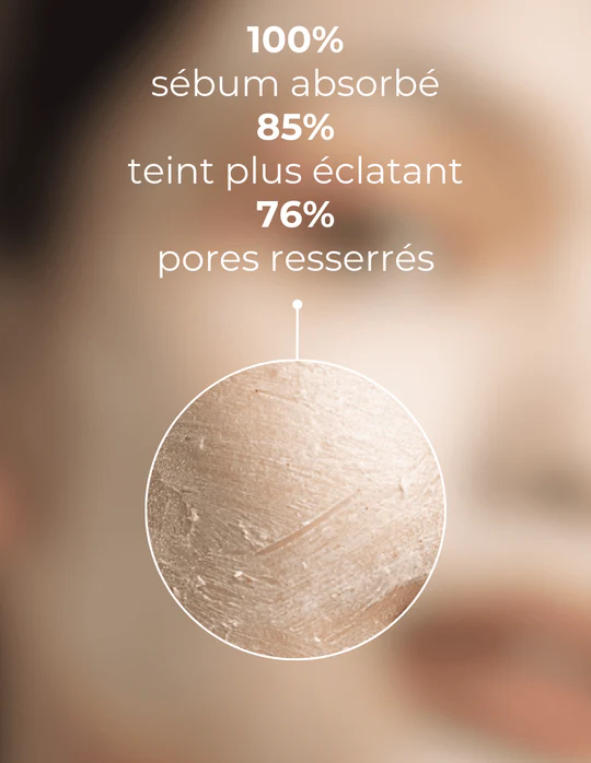 DERMEDEN - Wholesale Skincare Face Mask - Exfoliating Mask Detox 2 in 14