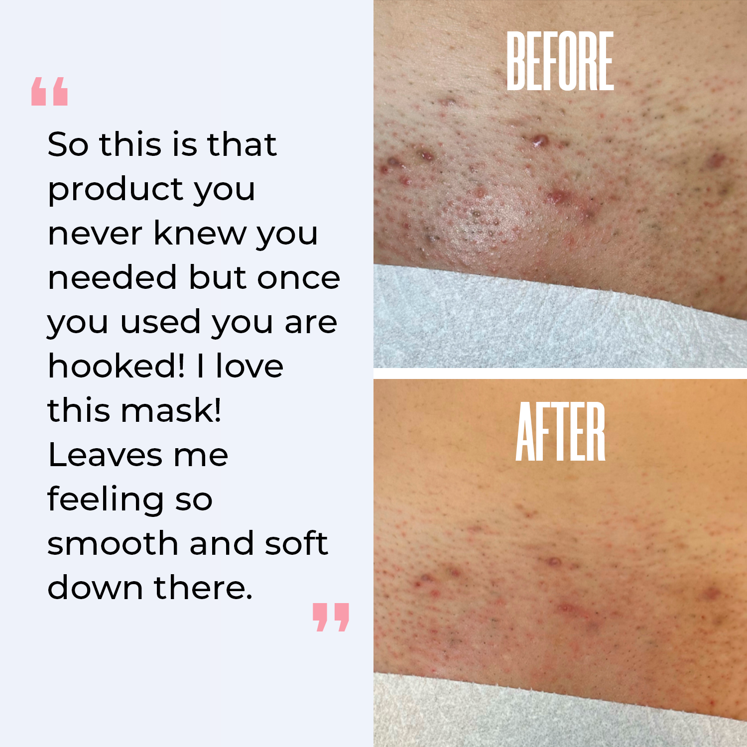 Divine Derriere - Vendita all'ingrosso Maschera viso - Kit hydrogel vajacial - acido ialuronico6