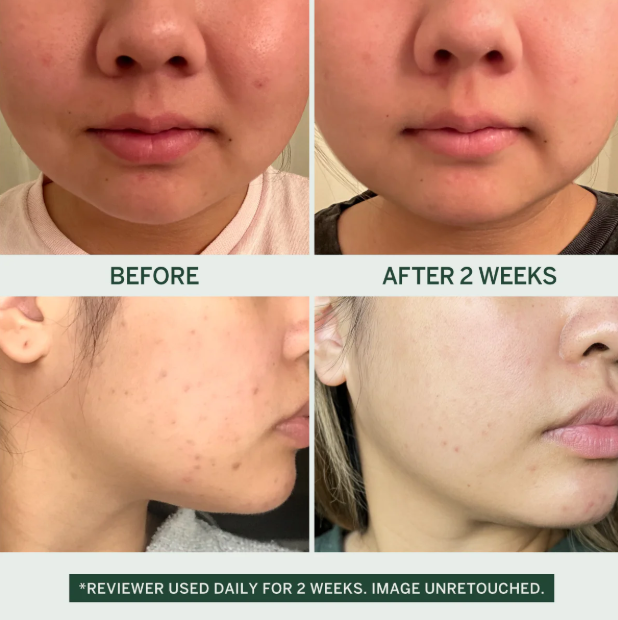 FaceTory - Wholesale Facial Cleanser - Korean Beauty - Cleanser w/Fermented Pear & LHA - Urban Calm5