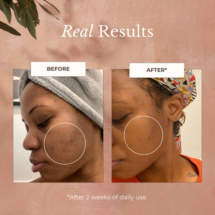 Apoterra – Engroshandel Ansigts- og kropsspray – Neroli Afklarende teint tåge3