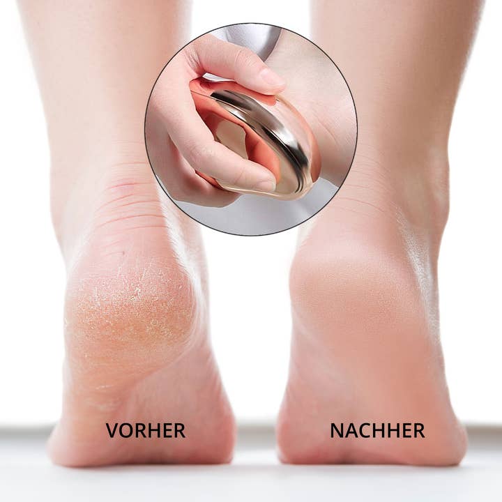 AILORIA - Vente Gommage/exfoliant pour les pieds - Doucette innovant en nano-verre pour élimination des callosités18