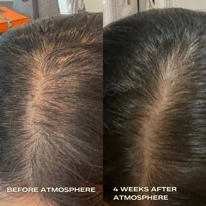 Luna Nectar - Wholesale Scalp/Hair Treatment - Atmosphere Multi-Peptide Hair Density & Scalp Serum