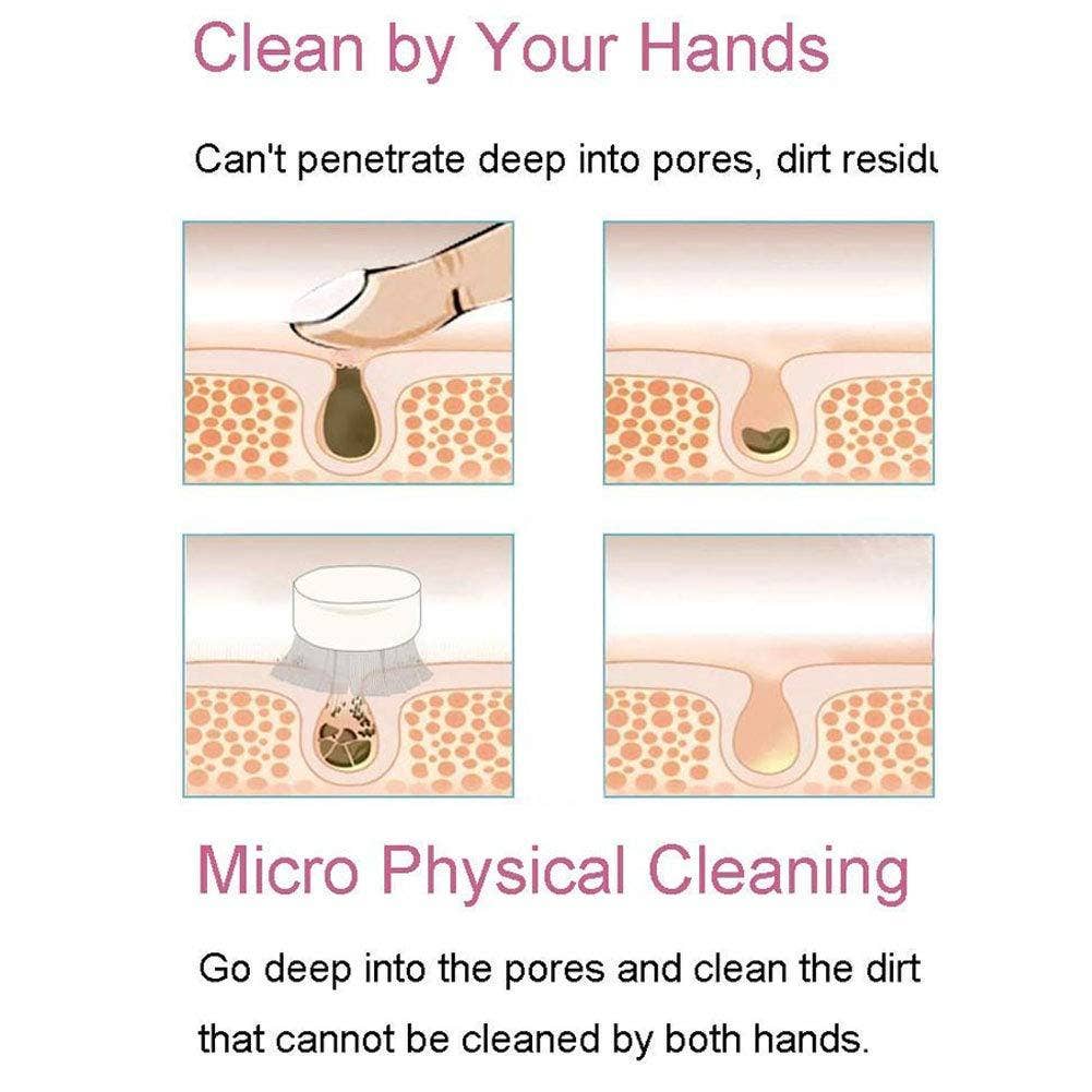 Savoy Active - Vente Appareil électrique pour soins de la peau - Brosse nettoyante pour le visage portable - Rose3