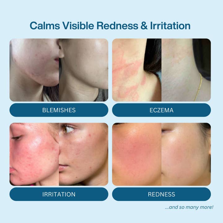 VC LEMONADE CORP. - Wholesale Face & Body Mist/Water - Hypochlorous Acid Spray for Face & Body3