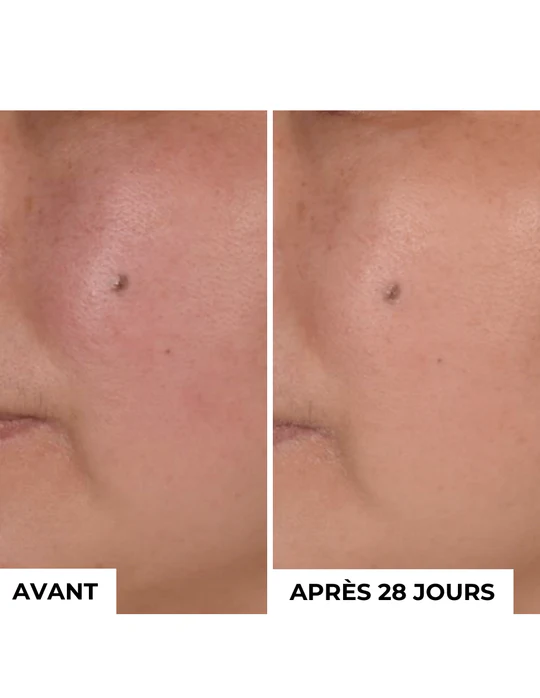 DERMEDEN - Wholesale Skincare Face Mask - Exfoliating Mask Detox 2 in 12