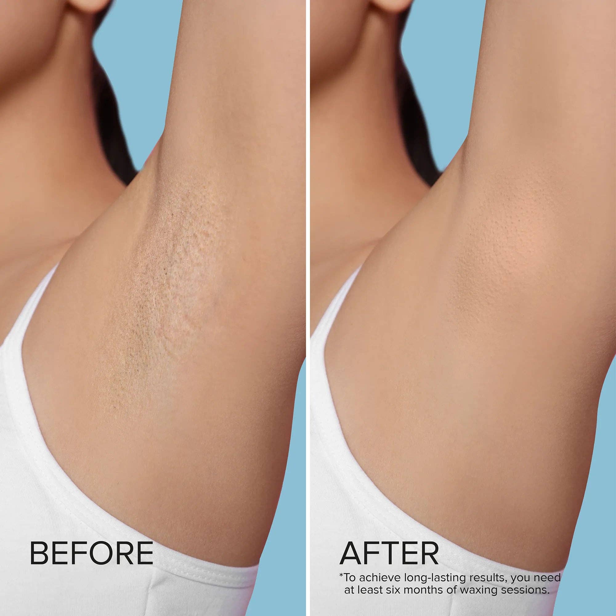 VIAI Beauty - Wholesale Body Hair Removal Product - Hard Wax Beads for Hair Removal5