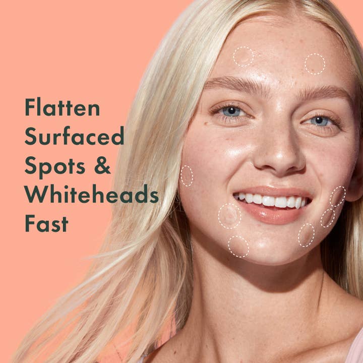 Rael - Wholesale Acne/Hydrocolloid Patch - Rael Miracle Patch Invisible Spot Cover - Pimple Patch, Acne1