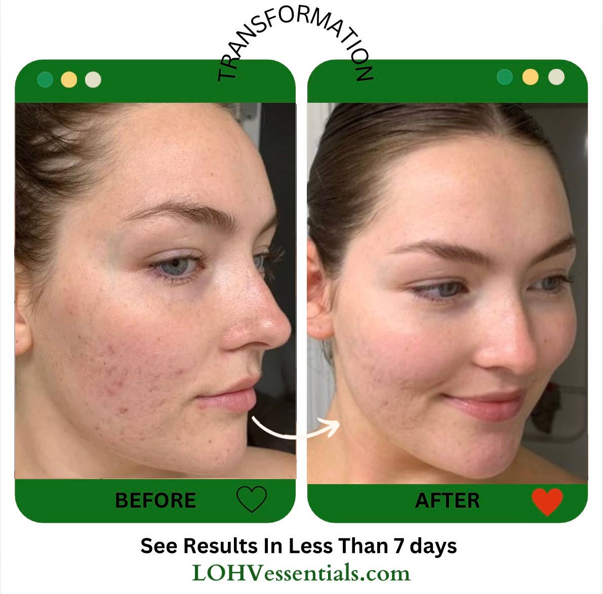 LOHV ESSENTIALS - Wholesale Facial Cleanser - PREMIUM 100% VEGAN CLEANSE THE DAY AWAY Face Cleanser with Hyaluronic Acid + Lactic Acid + Glycolic Acid Face Cleanser2