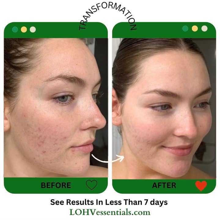 LOHV ESSENTIALS - Wholesale Facial Cleanser - PREMIUM 100% VEGAN CLEANSE THE DAY AWAY Face Cleanser with Hyaluronic Acid + Lactic Acid + Glycolic Acid Face Cleanser2