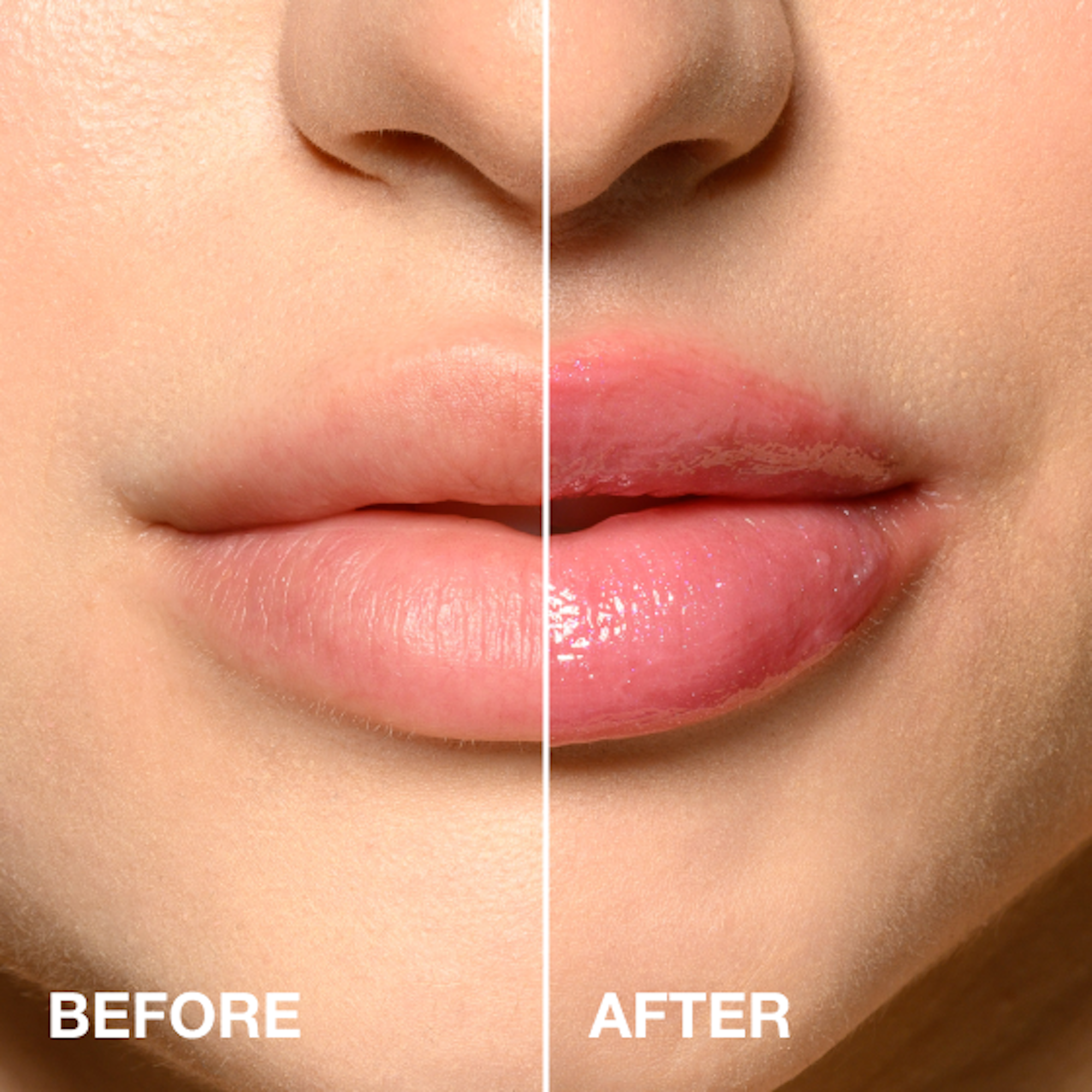 Sara Happ - Venta al por mayor Voluminizadores de labios - El Voluminizador de Labios: Rosa Carnoso2