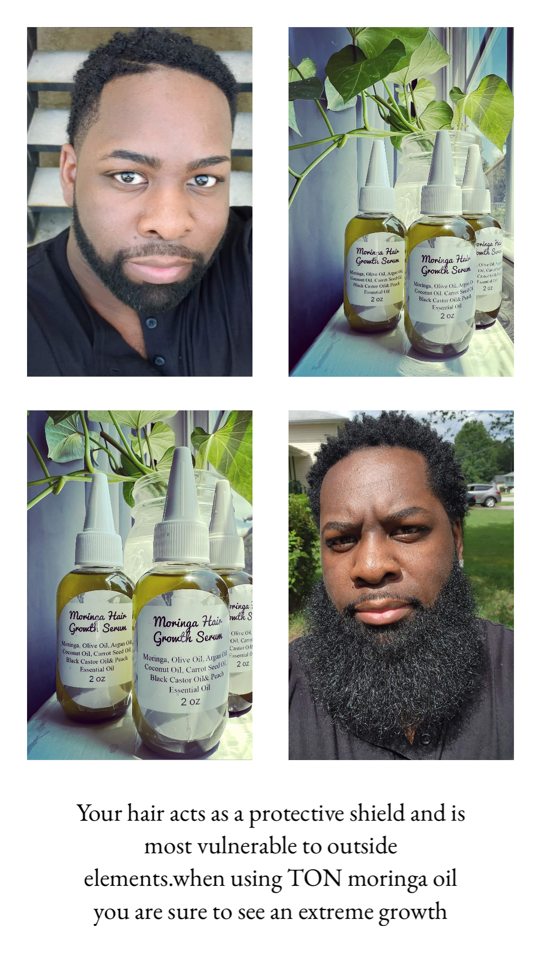 Touch of Nature Boutique - Wholesale Hair Oil - Moringa Hair Growth Serum| Beard Oil2