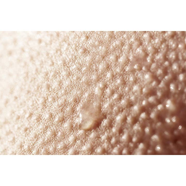 Medical Office Art - Goosebumps for wholesale by Queence