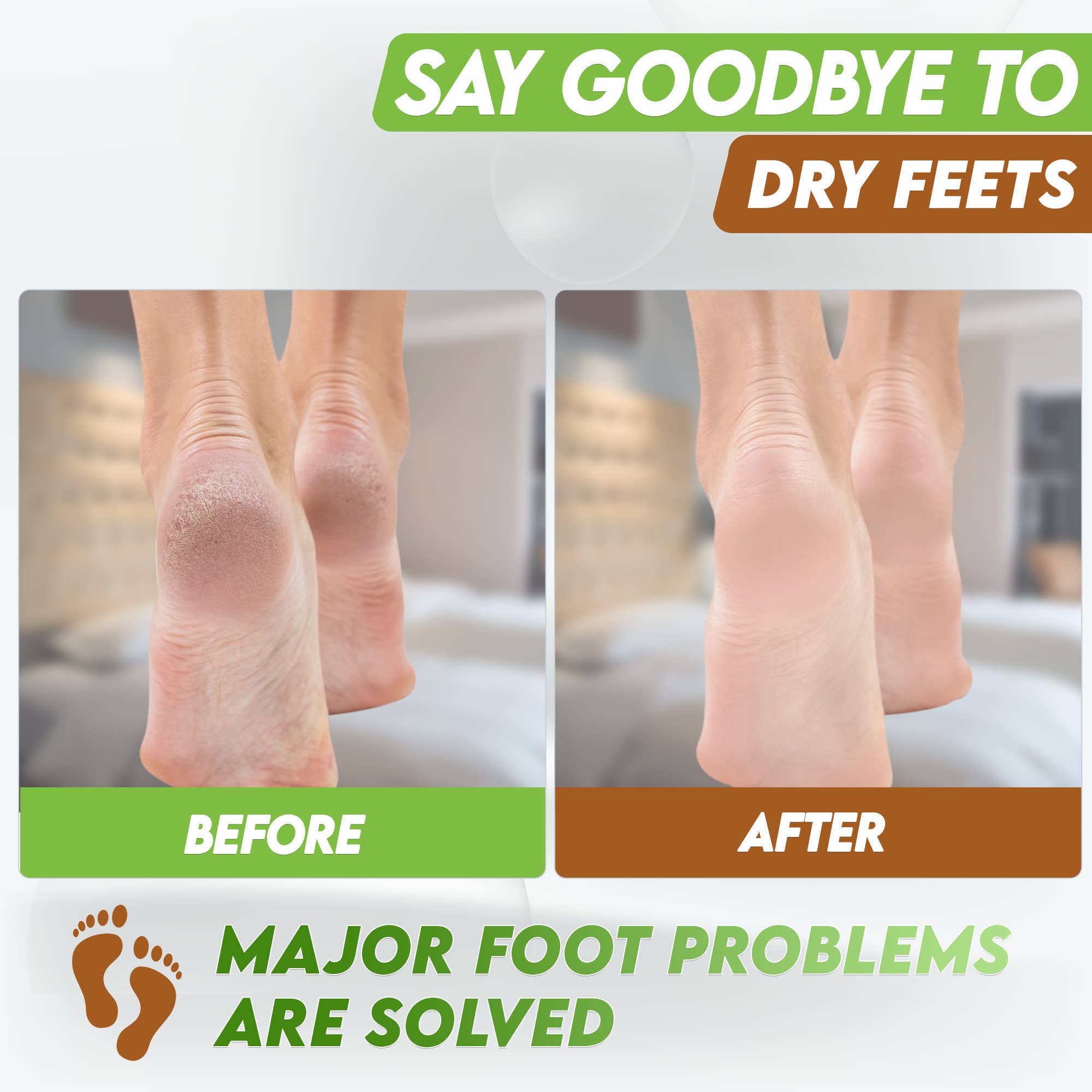 Karma Organic spa - Wholesale Foot Mask - Foot Peel Mask 2 Pack –Coconut Peeling Mask 100% Organic4