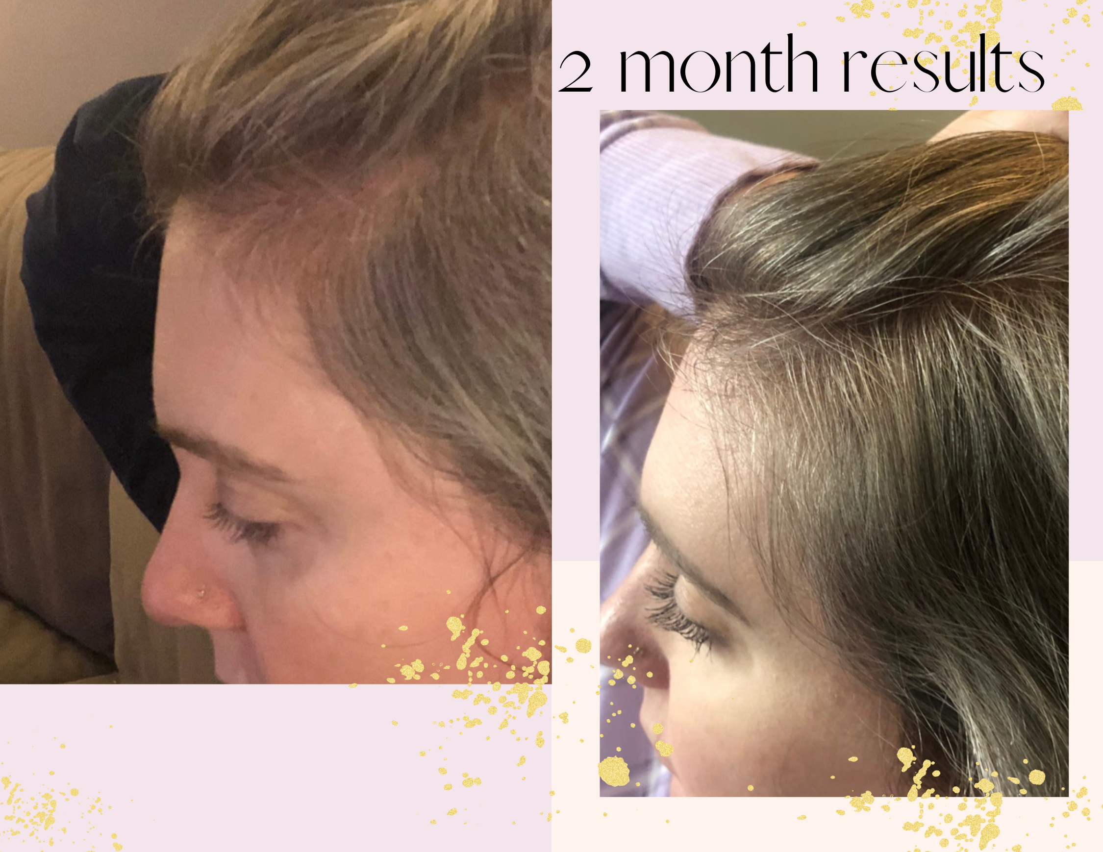 Sutton Michelle Designs - Wholesale Hair Oil - Growth Scalp Oil10