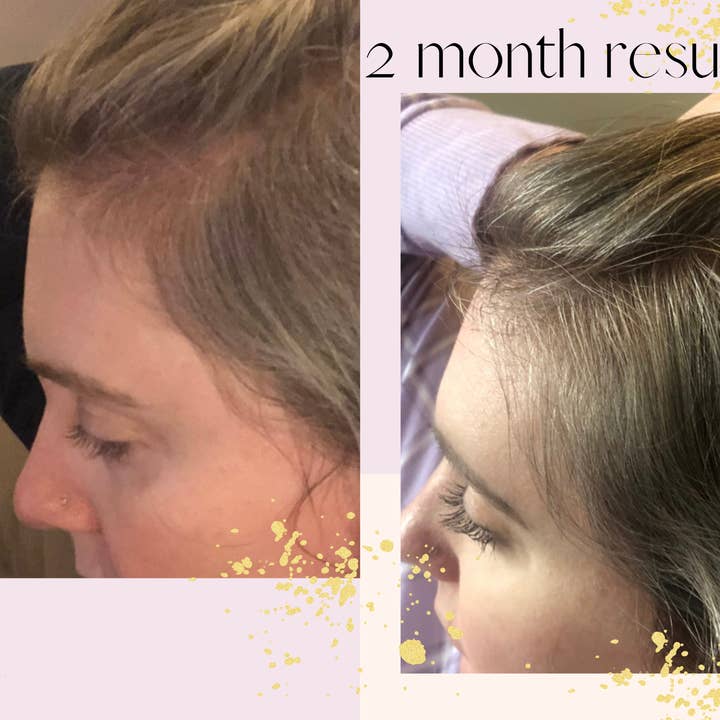 Sutton Michelle Designs - Wholesale Hair Oil - Growth Scalp Oil10