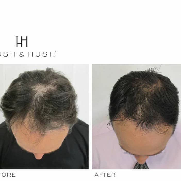 Hush & Hush - Wholesale Hair Serum - Hair Growth Serum for Healthy Scalp & Hair4