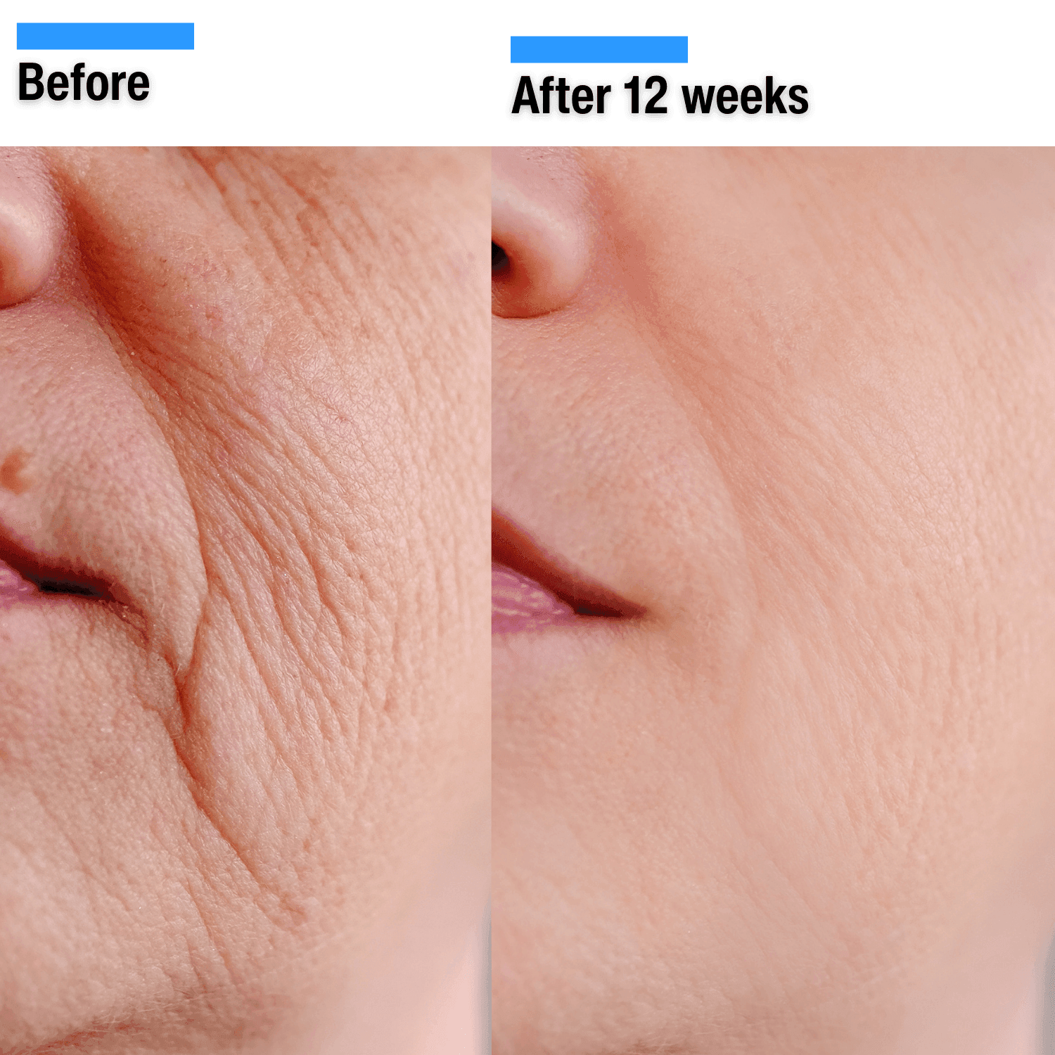 Gymsegbe - Wholesale Facial Care Set/Kit - The Luxury Bundle10