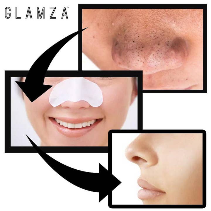 My Wholesale Warehouse - Venta al por mayor Parches para el acné/hidrocoloides - Tiras nasales de limpieza profunda Glamza para espinillas