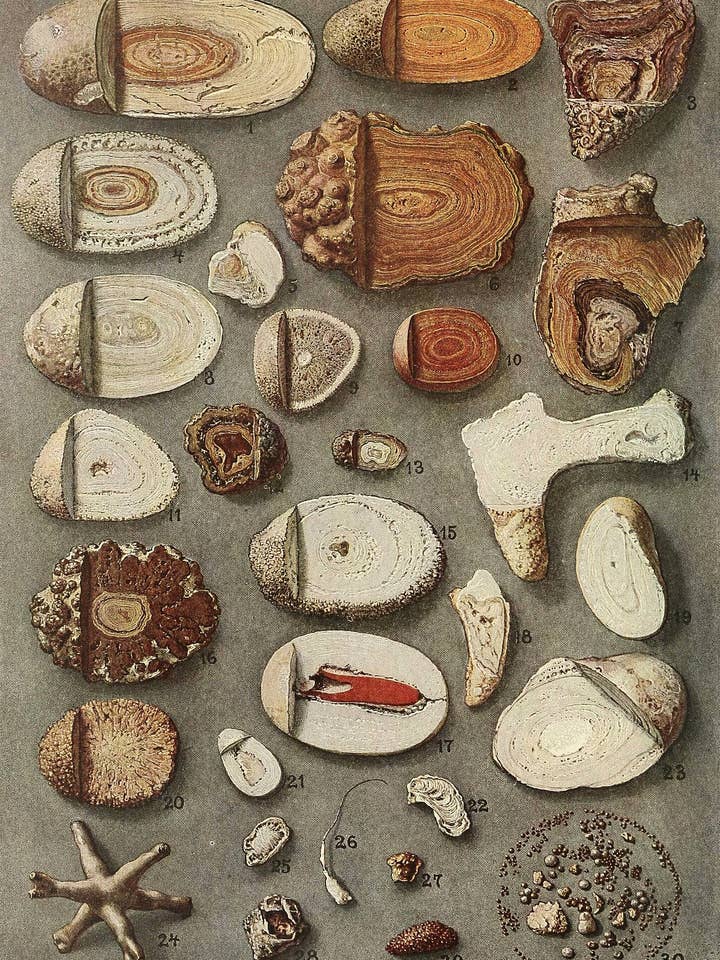 Cálculos renales y vesicales de Max Brödel, 1909 - Papel de regalo para venta al por mayor de Flashback Shop