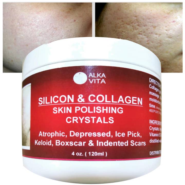 AlkaVita - Wholesale Hydrocolloïde acnepleister - Acne Huidlittekens SILICON Polishing Crystals Gel Ingesprongen huid