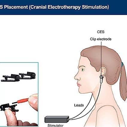 GoLiveAi - Wholesale Earplugs - Ear Clip Compatible with Vagus Nerve Device 2,5 mm Port 1