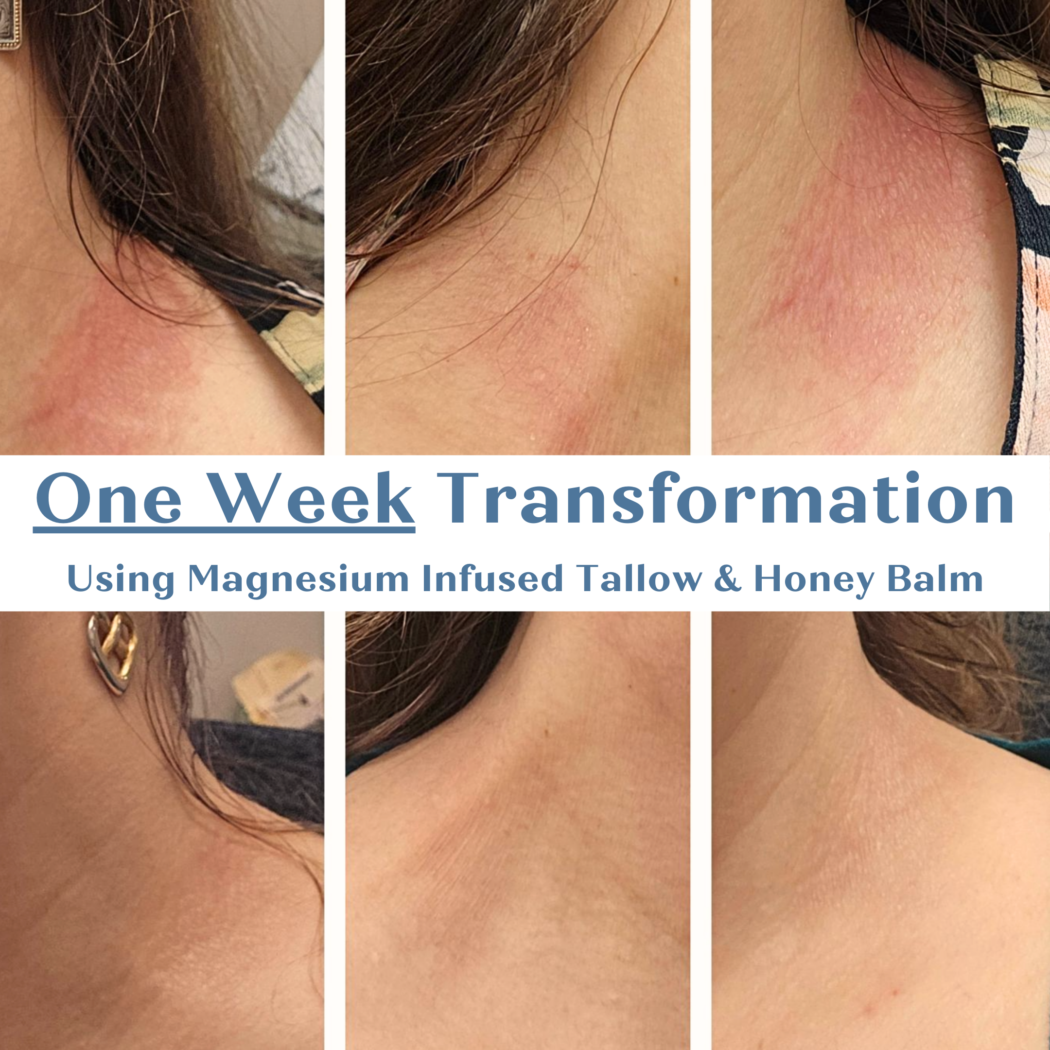 Rapha Blends - Wholesale Body Balm/Butter - Magnesium Infused Tallow & Honey Balm3