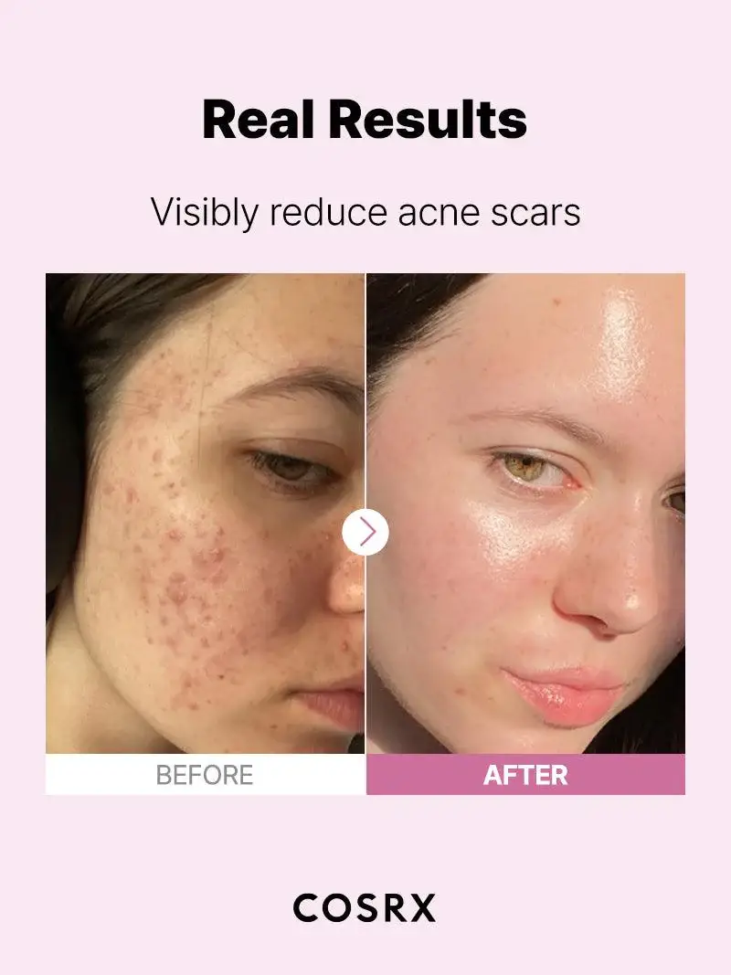 Kosmic - Kbeauty Skincare - Vente Concentré/sérum pour le visage - [COSRX] Sérum Niacinamide 15 % 20 ml4