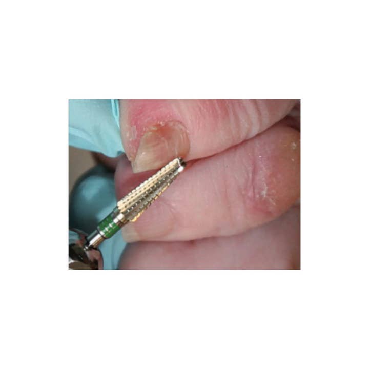 My Podologie - Wholesale Nail Clipper/Scissor - Strawberry 5675 - Carbide + Zirconium - Simple denture with cross-cut - 4 mm2