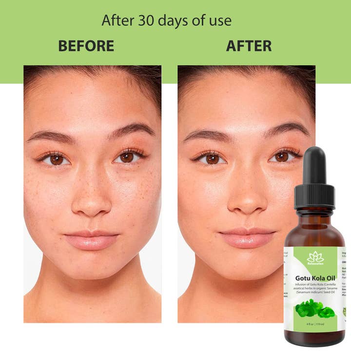 Relaxcation - Vendita all'ingrosso Olio bagno/corpo - Olio vettore puro naturale di Gotu Kola (Centella)9