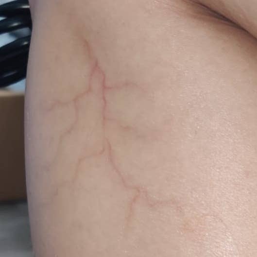 INFECTED VEIN (A) TATTOO for wholesale by DESIRED FX