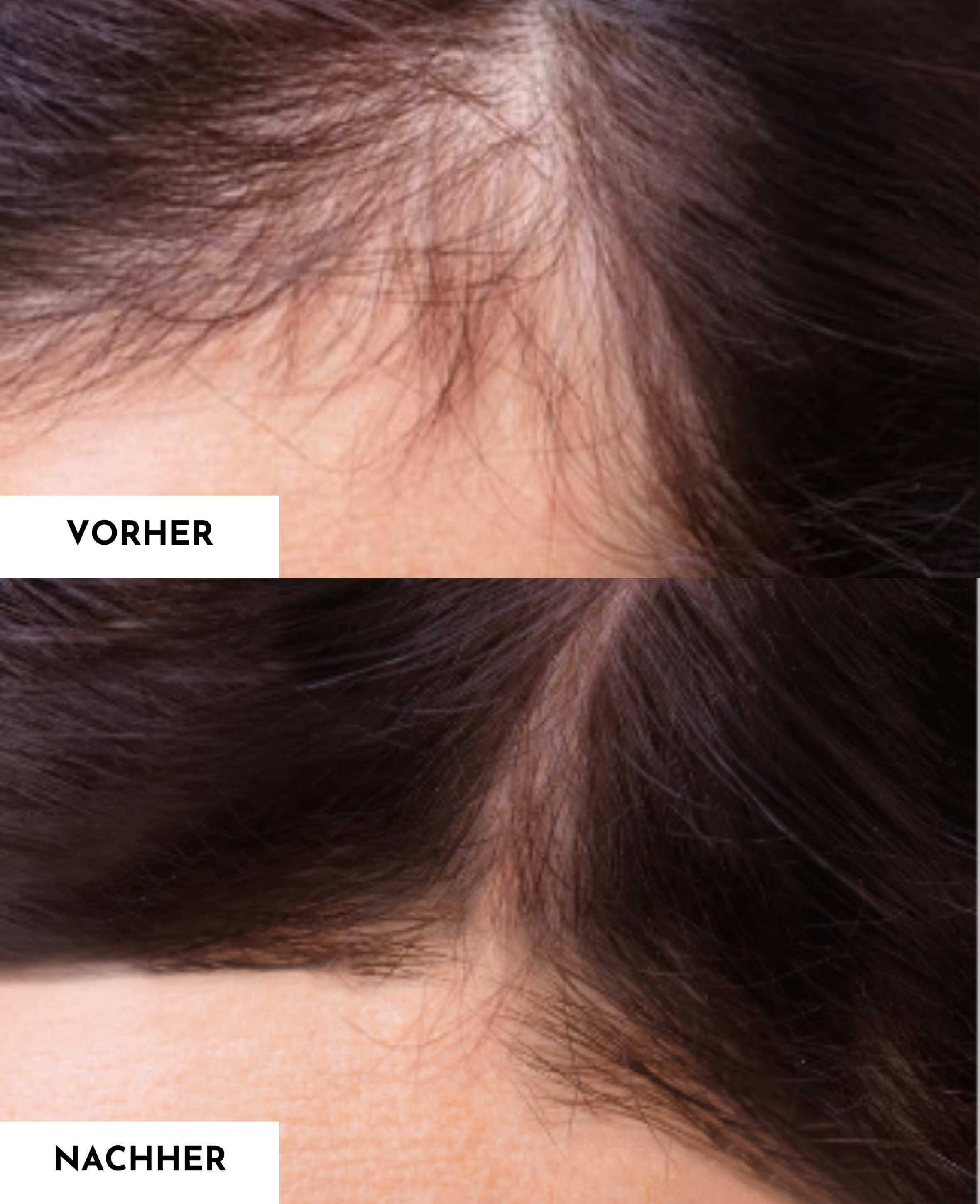 ELLENITY – wholesale Hair serum – Haarwachstums-Booster Kopfhautmassage-Set4