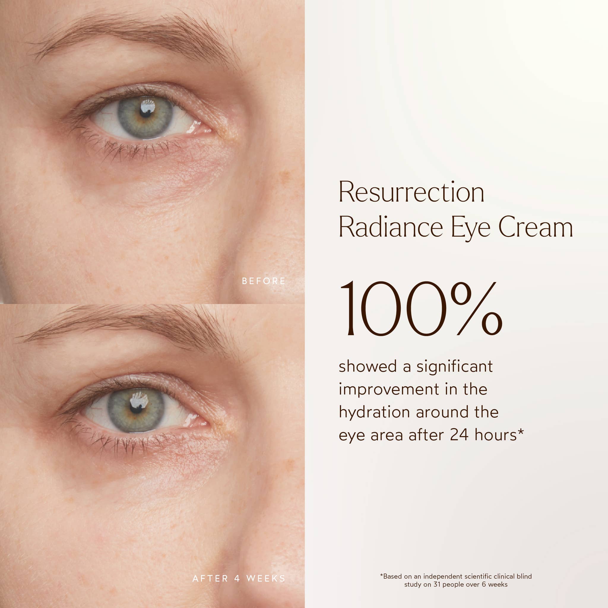 True Botanicals - Wholesale Eye Cream/Gel - Renew Resurrection Radiance Eye Cream4