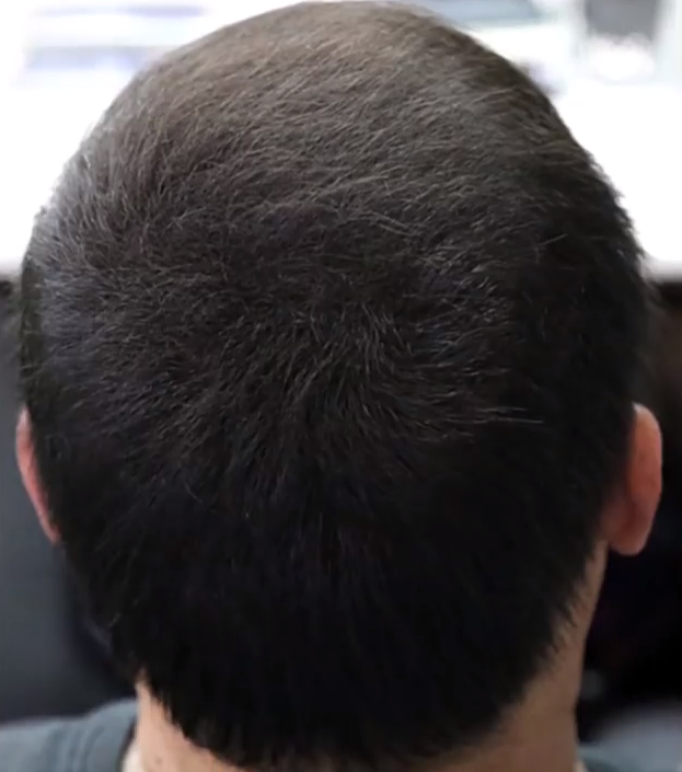 My Wholesale Warehouse – wholesale Hair thinning/loss treatment – Volumon Hair Building Fibres - COTTON 12g14