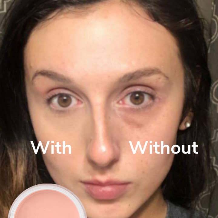 Sheer Miracle - Wholesale Eye Cream/Gel - Wide Awake Dark Circle Concealer Brightener Organic & Vegan1