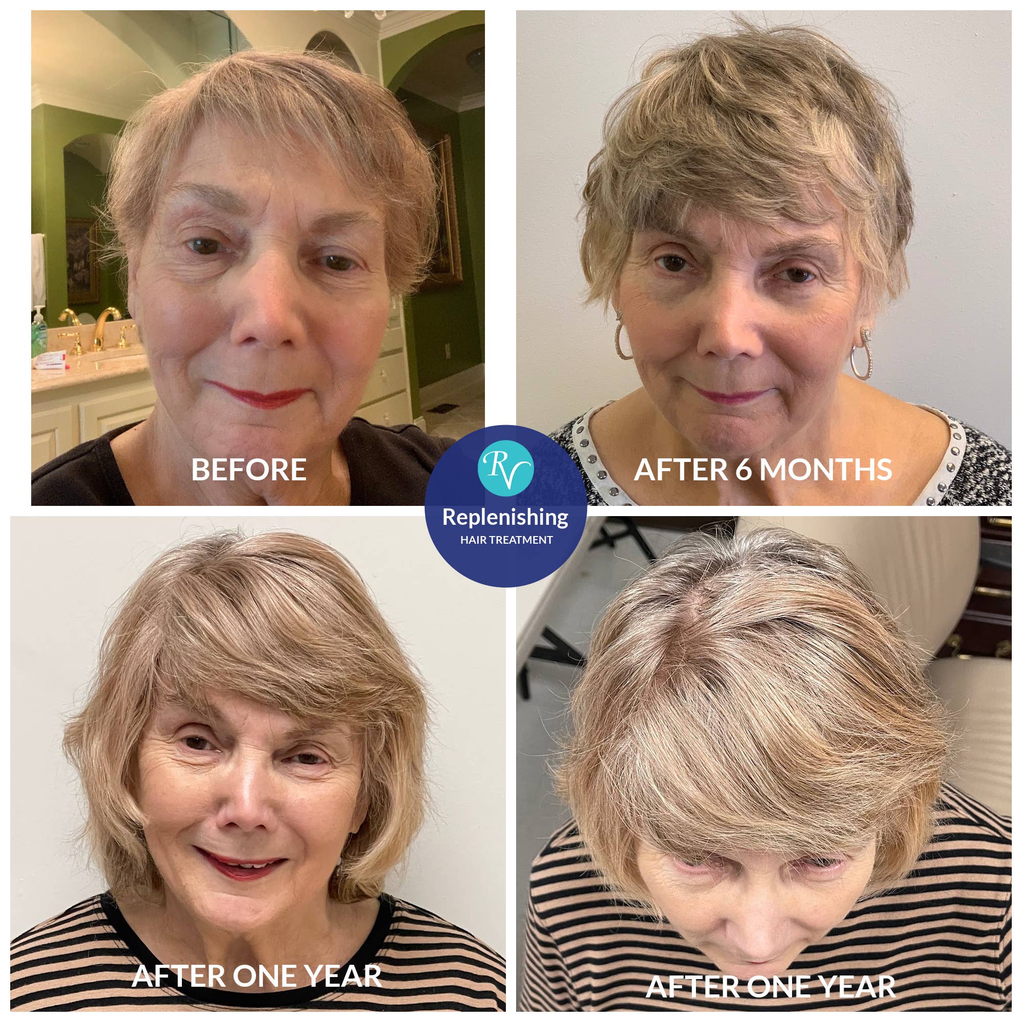 RemeVerse - Wholesale Hair Shampoo - Replenish Shampoo with Redensyl®4