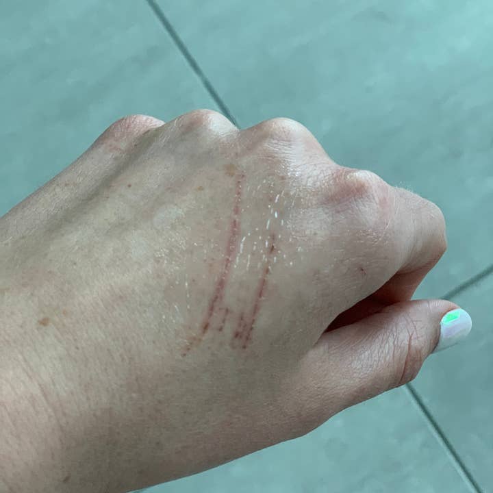 Cicamed - Wholesale Scar Cream - Cicamed Scar Removal and Correcting Gel with Silicone for Face and Body1