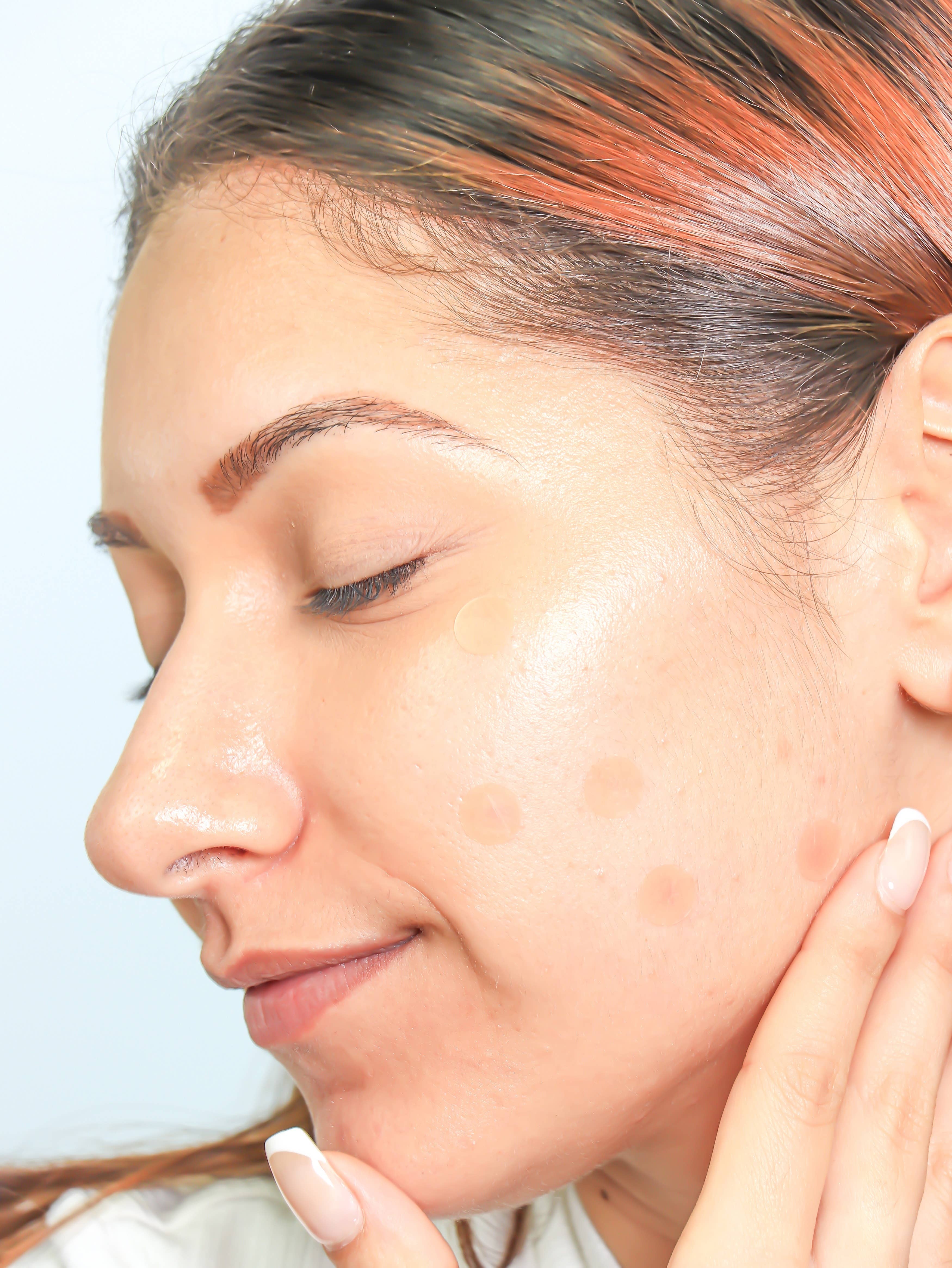 My Spa Life - Wholesale Acne/Hydrocolloid Patch - Skin tint hydrocolloid pimple patches - 14 Patches10