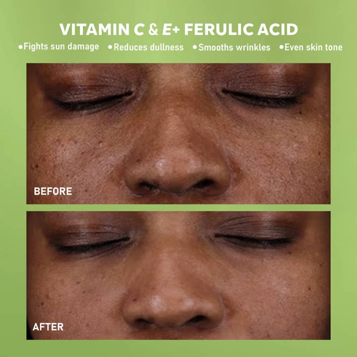 DERMAdoctor - Vente Concentré/sérum pour le visage - Kakadu C 20 % de sérum vitamine C avec acide ferulique et vitamine E1