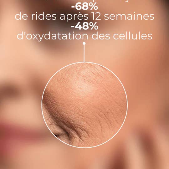 DERMEDEN - Wholesale Anti-Aging Moisturizer - 4 in 1 Day Cream Global Action Combination to Oily Skin3