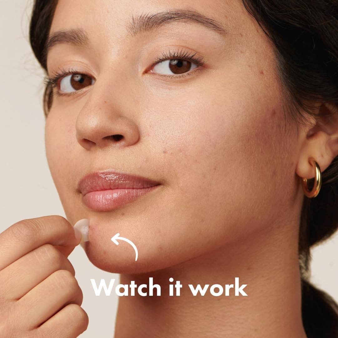 MEHIAZ - Wholesale Acne/Hydrocolloid Patch - Mighty Patch Original – Spot Patches9