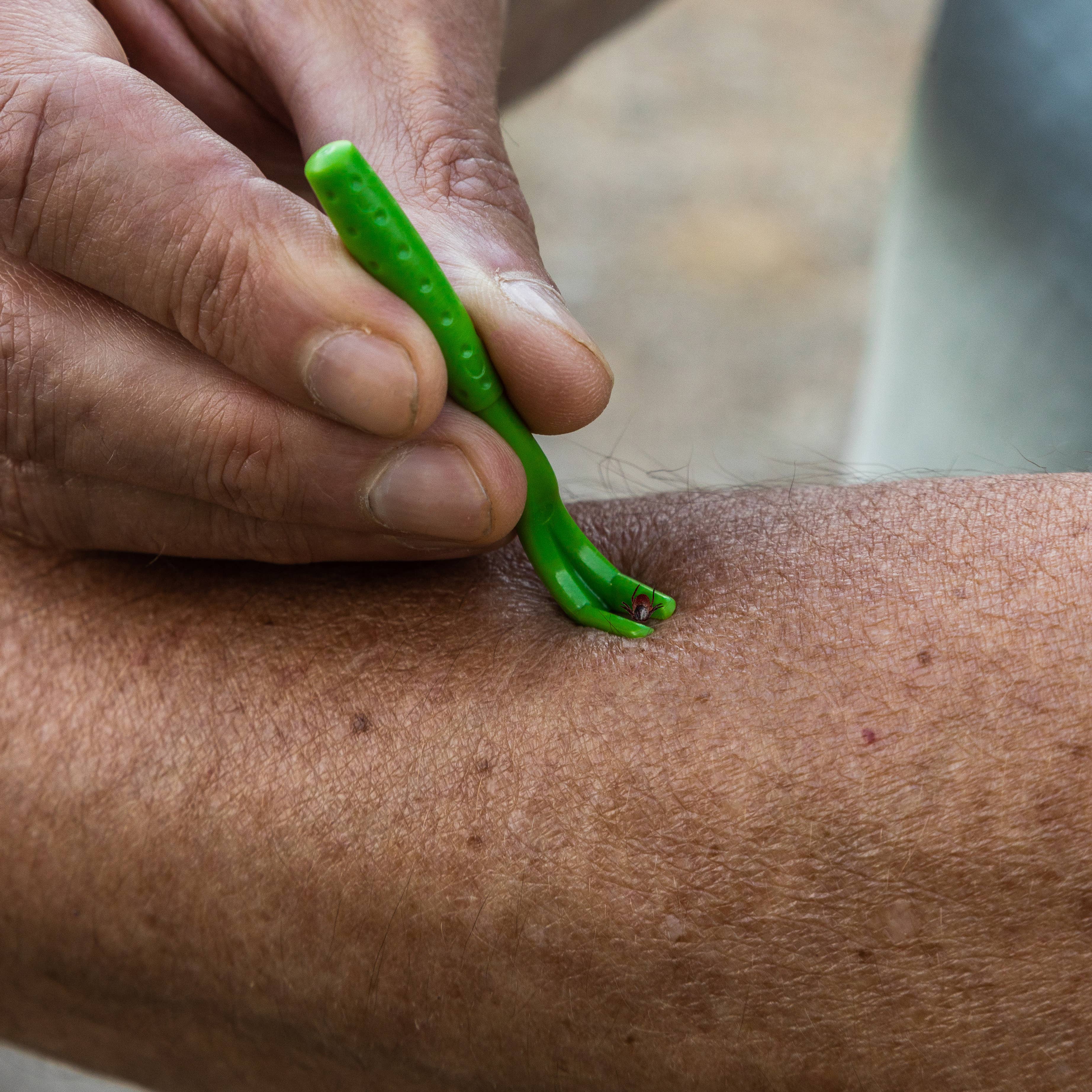 TickCheck – wholesale Verktyg för husdjursvård – Hund – TickCheck Tick Remover Value 3-pack - 12st Hänglist Display3