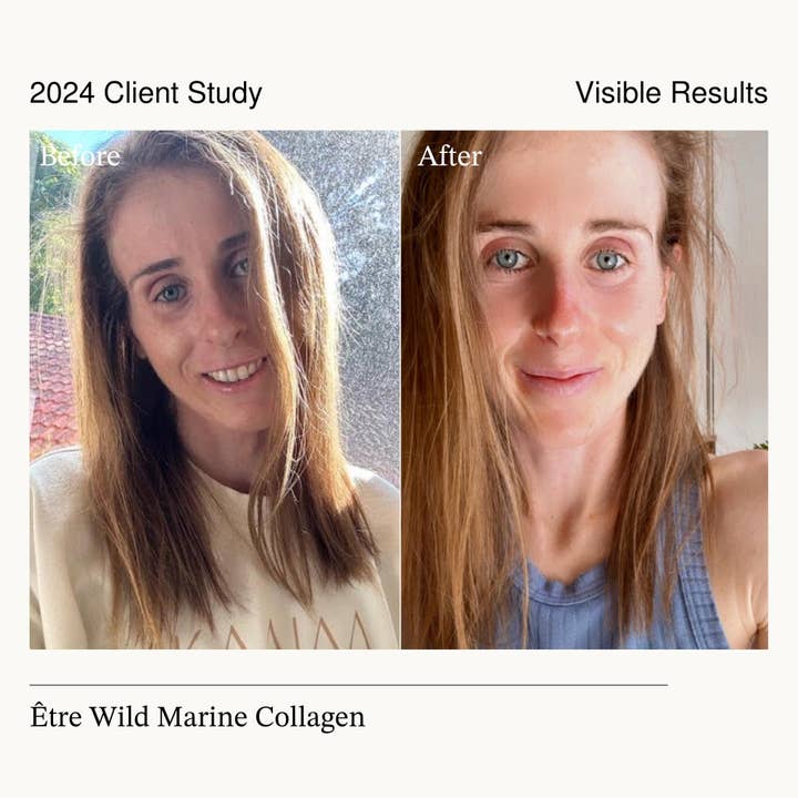 Etre Health Pty Ltd - Wholesale Oral supplement/vitamin - Glow & Beauty | Wild Marine Collagen2
