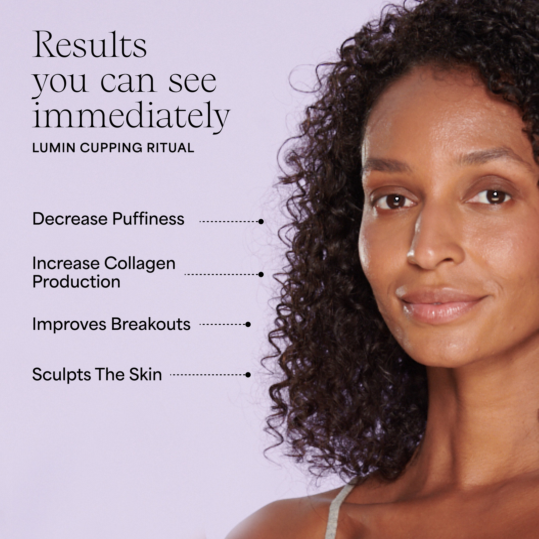 Wildling - Wholesale Body Cupping Set - Lumin Cupping Set2