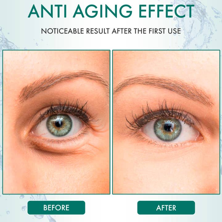 MASHELE - Wholesale Eye Treatment Mask - Aloe Vera Hyaluronic Acid Collagen Under Eye Gel Patches