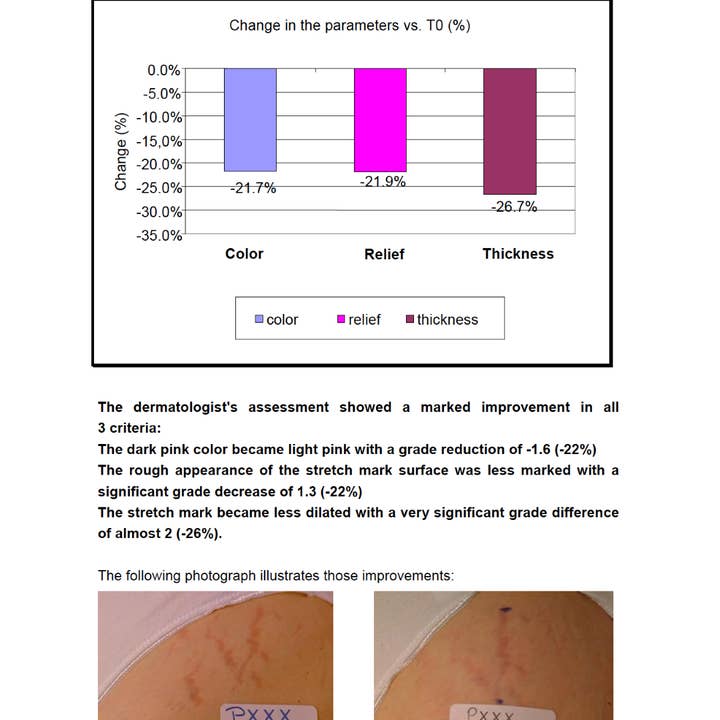 Elfeya Cosmetics – Óleo de barriga/manteiga - Maternidade por atacado – Creme Regestril Antiestrias3