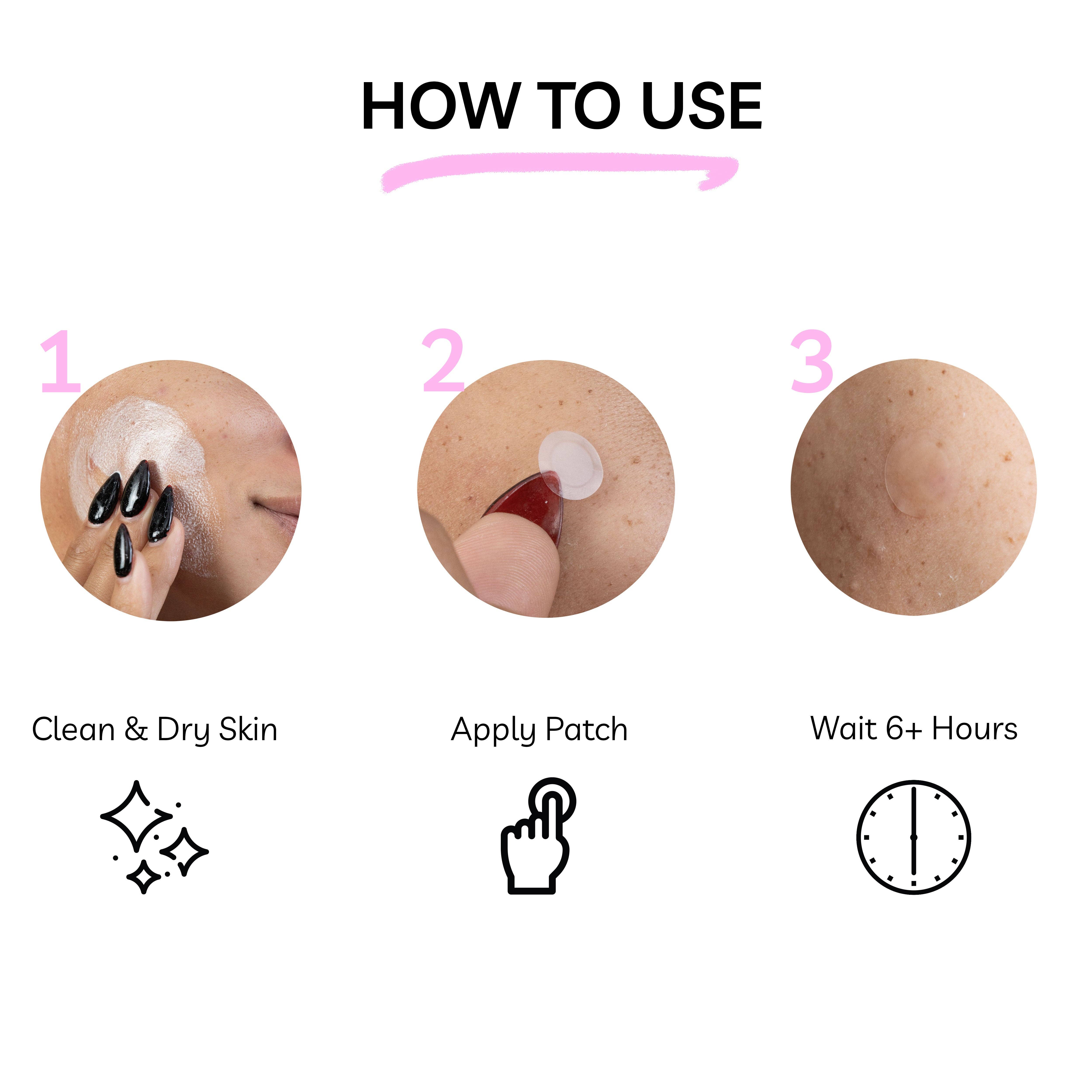 My Wholesale Warehouse - Vente Patch contre l'acné/hydrocolloïde - Patchs Hydrocolloïdes Anti-Imperfections Clear Molecule - Biseautés 12mm - Pack de 307