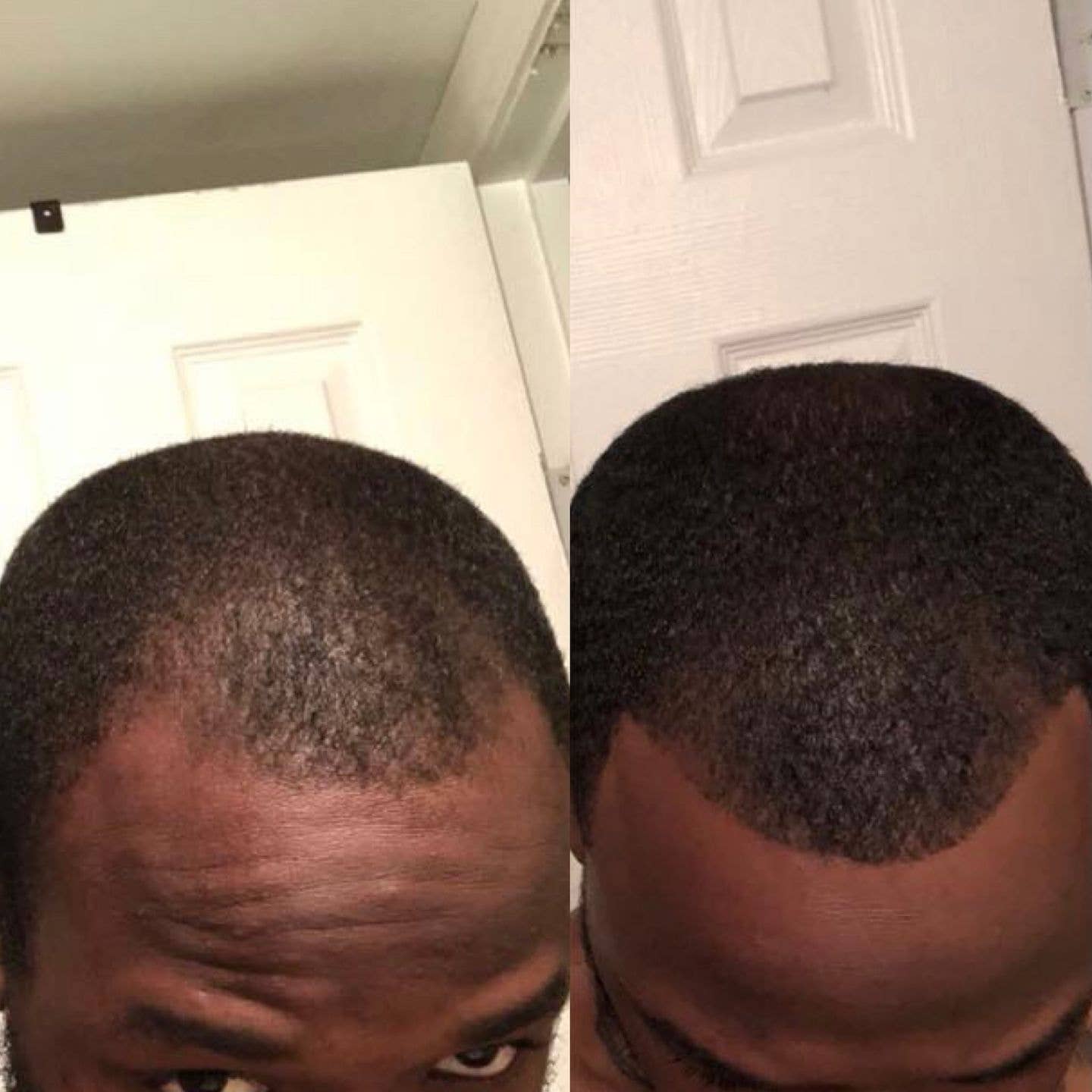 Hairresurrection - Wholesale Hair Oil - Intense Hair Growth Oil6