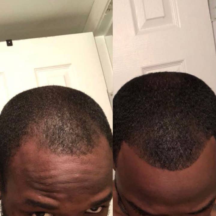 Hairresurrection - Wholesale Hair Oil - Intense Hair Growth Oil6