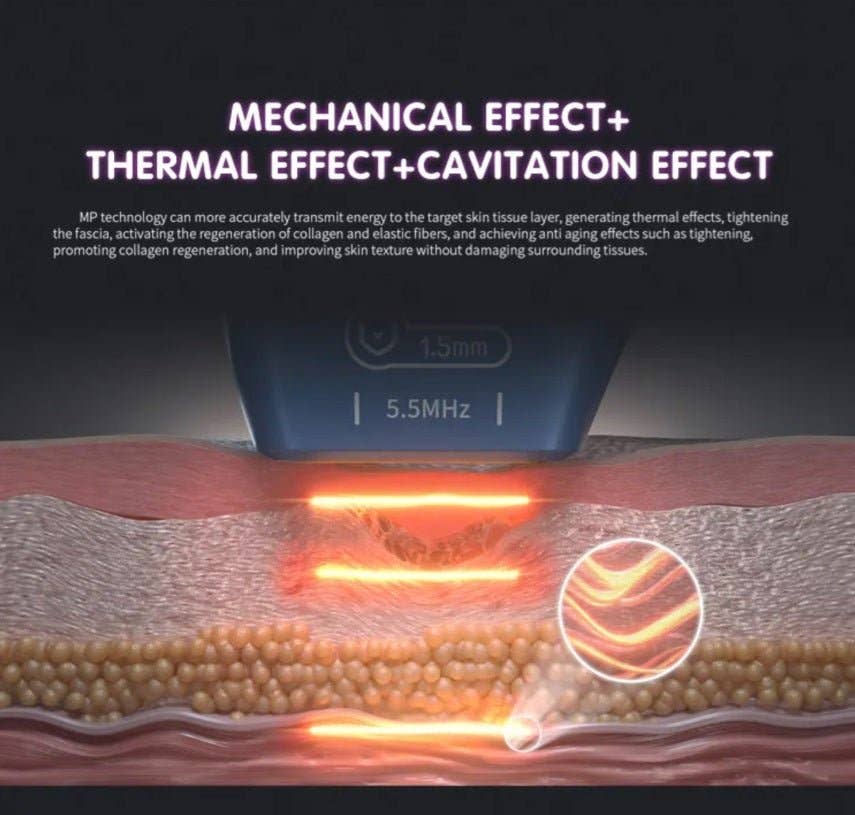 Cavitation Machines - Wholesale Electronic Skincare Device - Shape Tactics Advanced 3-Handle Dual Control 12D HIFU System13