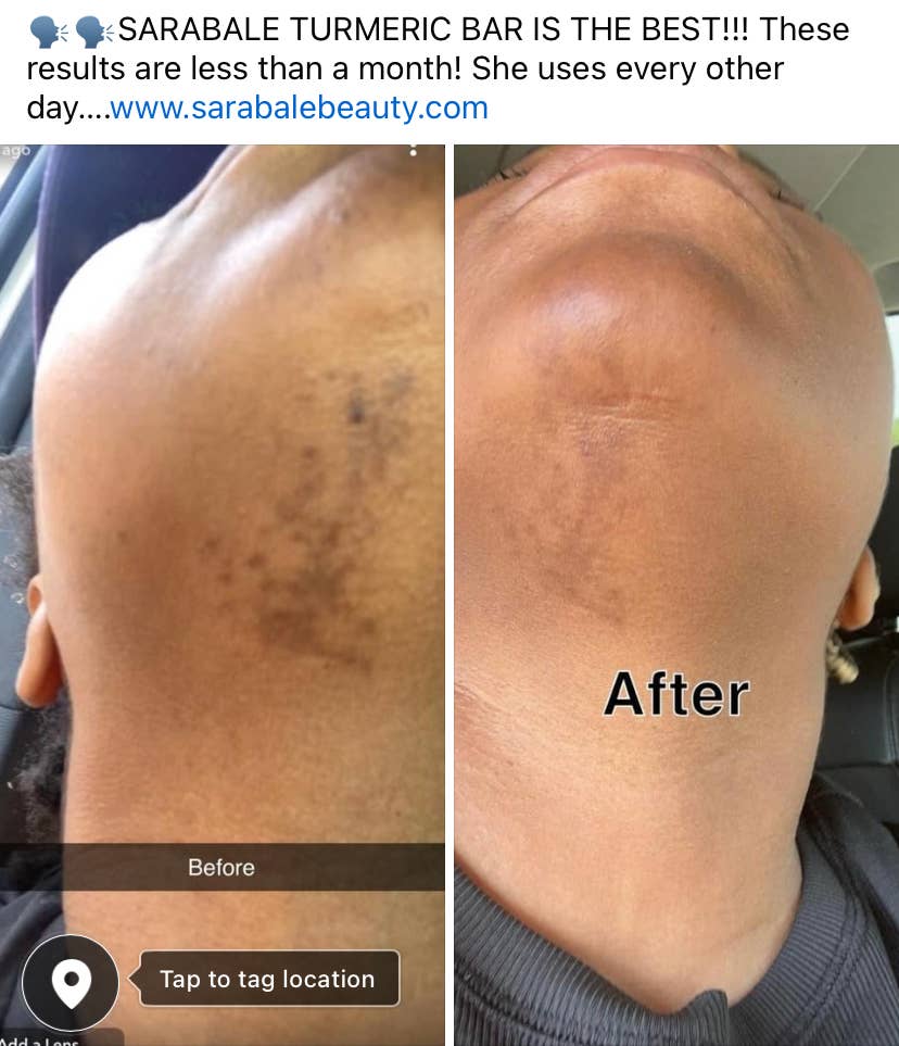 SaraBale Beauty - Wholesale Body Scrub/Exfoliant - SaraBale Turmeric & Kojic Powder Face/Body Bar0